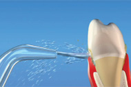 Desafíos dentales del tabaquismo y la enfermedad de las encías