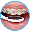 El mejor Waterpik™ para brackets dentales